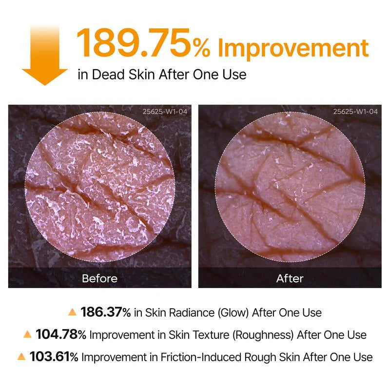 🔥【OFFICIAL STORE】Precise Care Kojic Acid Turmeric Spray 200ml