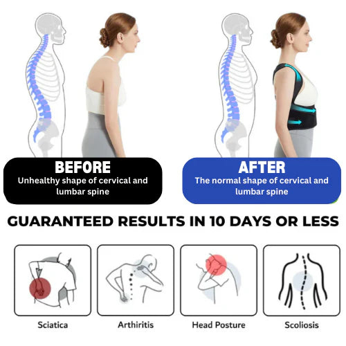 Posture Corrector