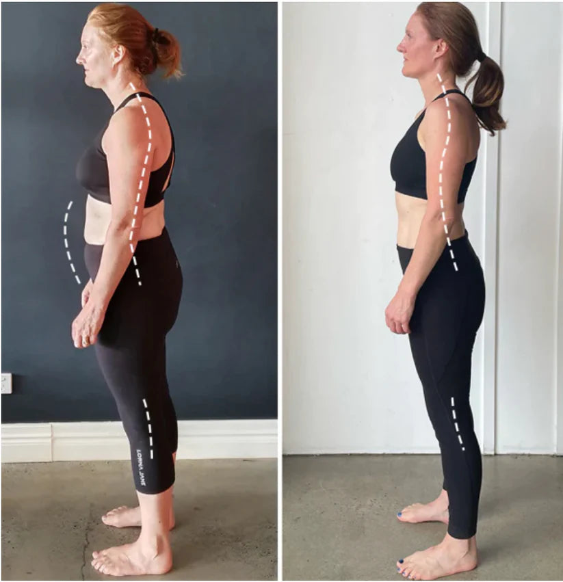 Posture Corrector