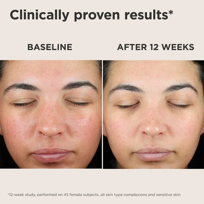 Green Color-Correcting Sunscreen SPF 50 – Neutralizes Redness & Evens Skin Tone